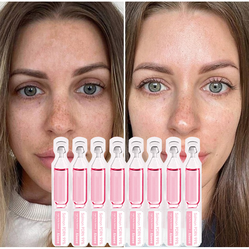 Salmon Serum Protein Peptide E – Peptide Complex Serum Bewertung und Preis