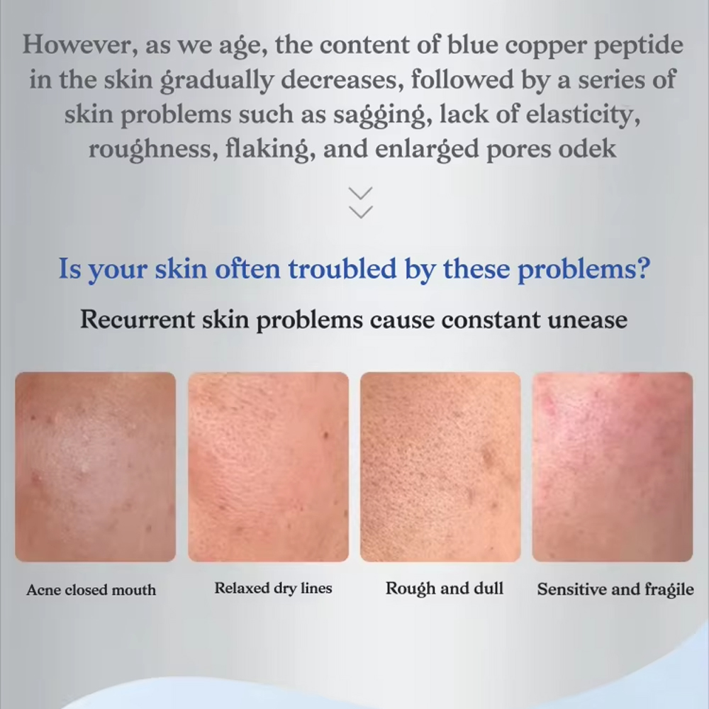 Blue Copper Peptide GHK-Cu Fre – Peptide Complex Serum Bewertung und Preis